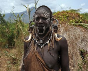 lipsa serviciilor medicale de igiena orala in Etiopia