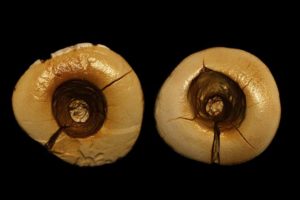 implant dentar sectiune