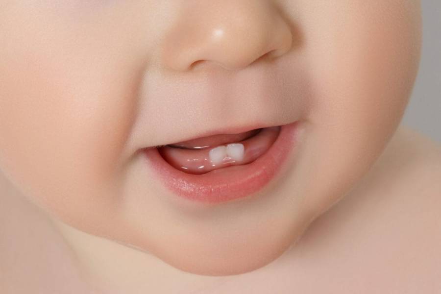 bebelus cu dinti natali