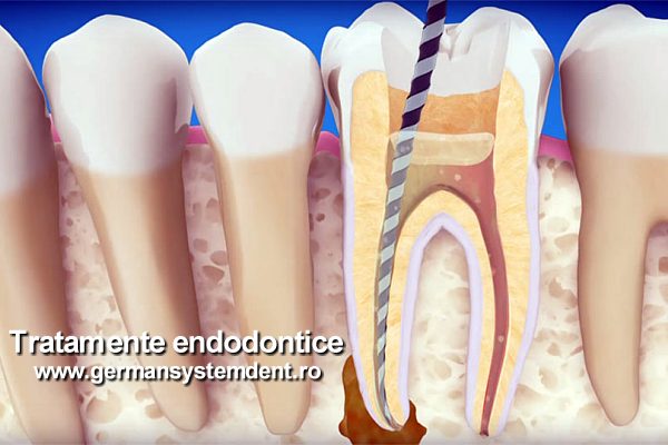 stomatologie endodontie